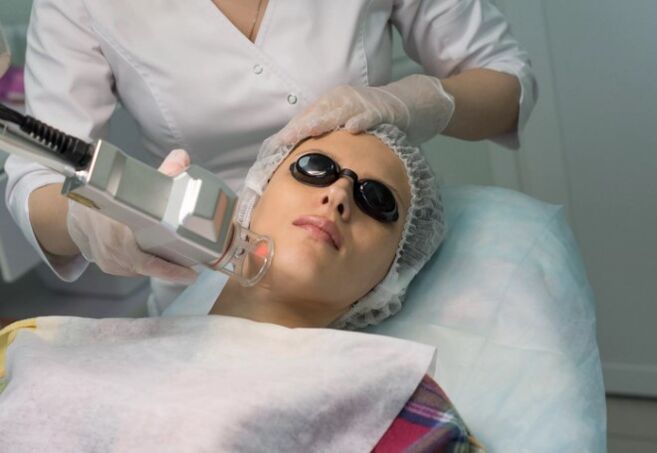 Field Rejuvenation ng isang laser